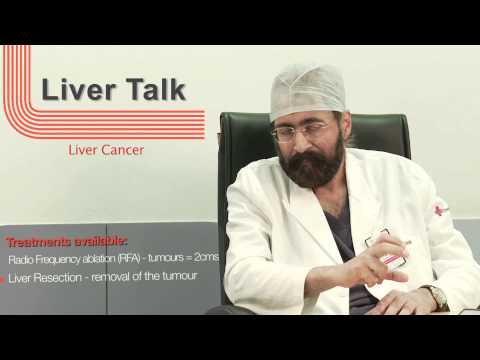  What is liver cancer? How to get it diagnosed? How is it treated?Learn about